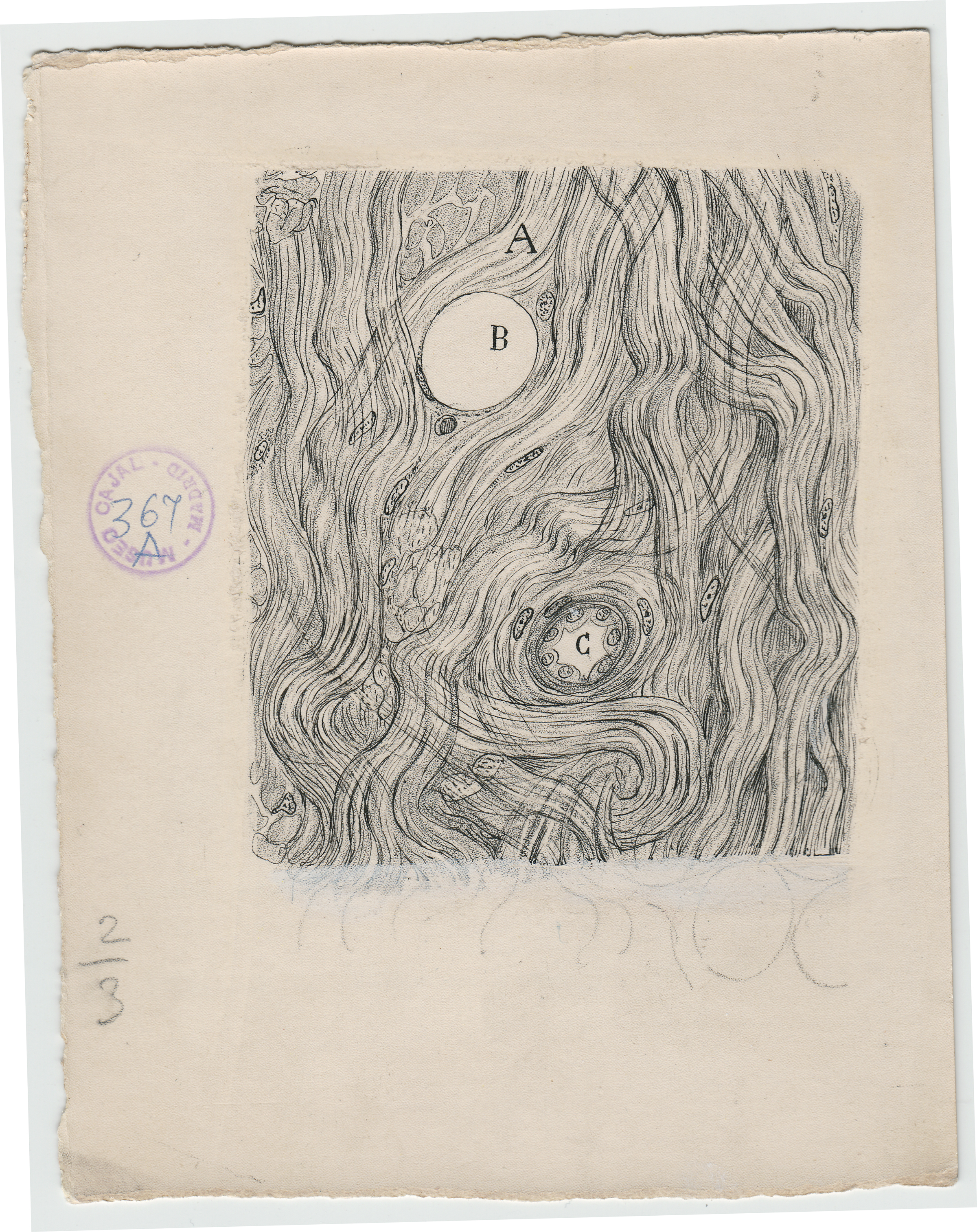 Santiago Ramón y Cajal, endotelioma de la duramadre, 1890, ink and pencil on paper. Courtesy of Instituto Cajal (CSIC).